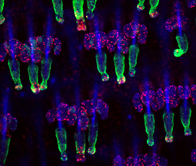 The skin's phenomenal ability to replenish itself comes from a reservoir of stem cells (shown in green in a mouse hair follicle).